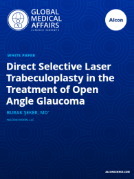 Direct Selective Laser Trabeculoplasty in the Treatment of Open Angle Glaucoma