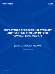 "Importance Of Rotational Stability And Tear Film Stability In Toric Contact Lens Wearers"